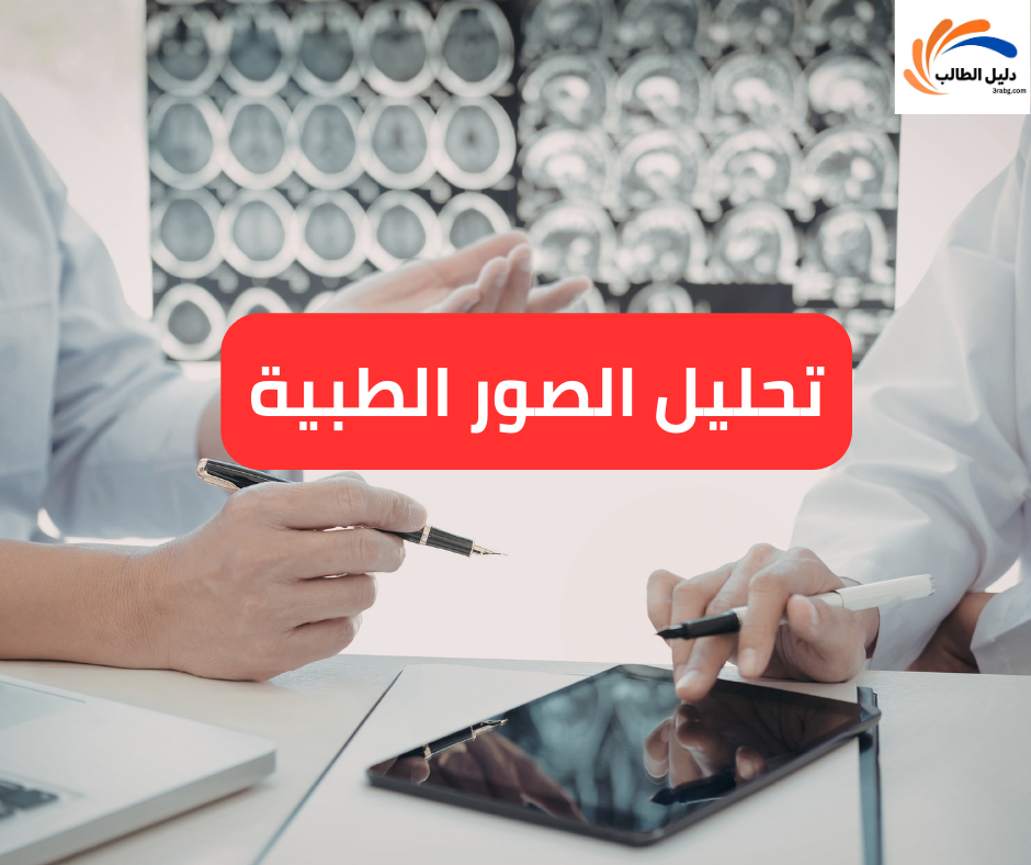 تحليل الصور الطبية