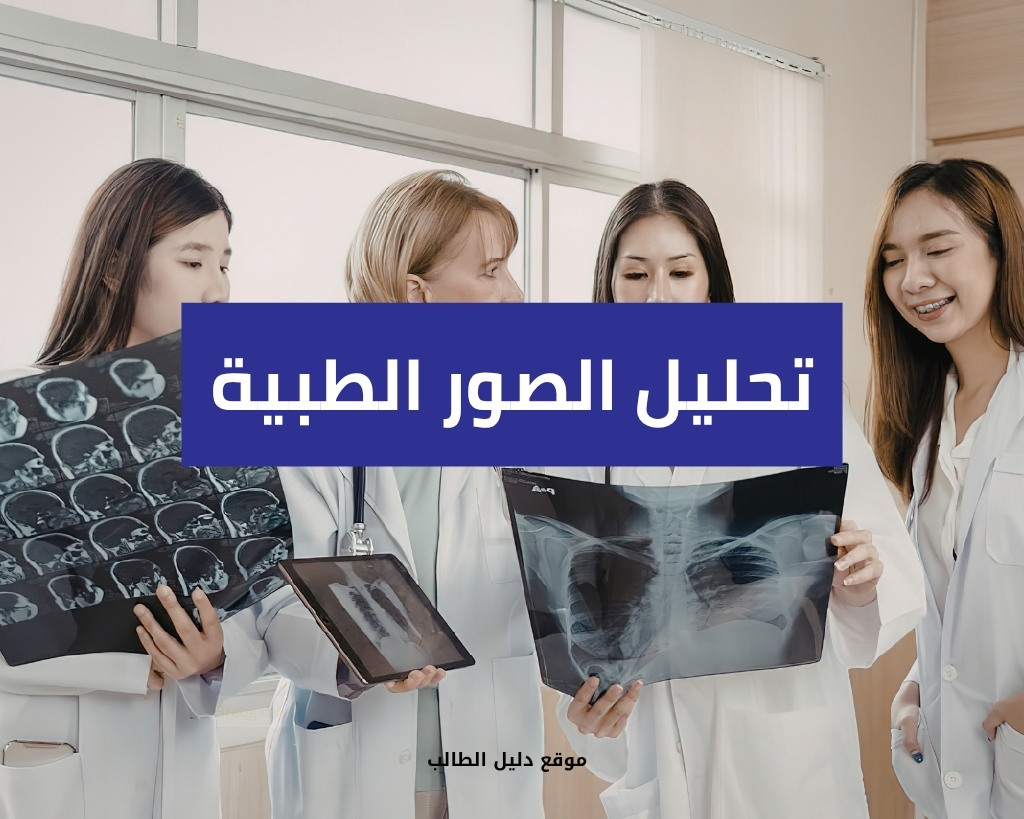 تحليل الصور الطبية